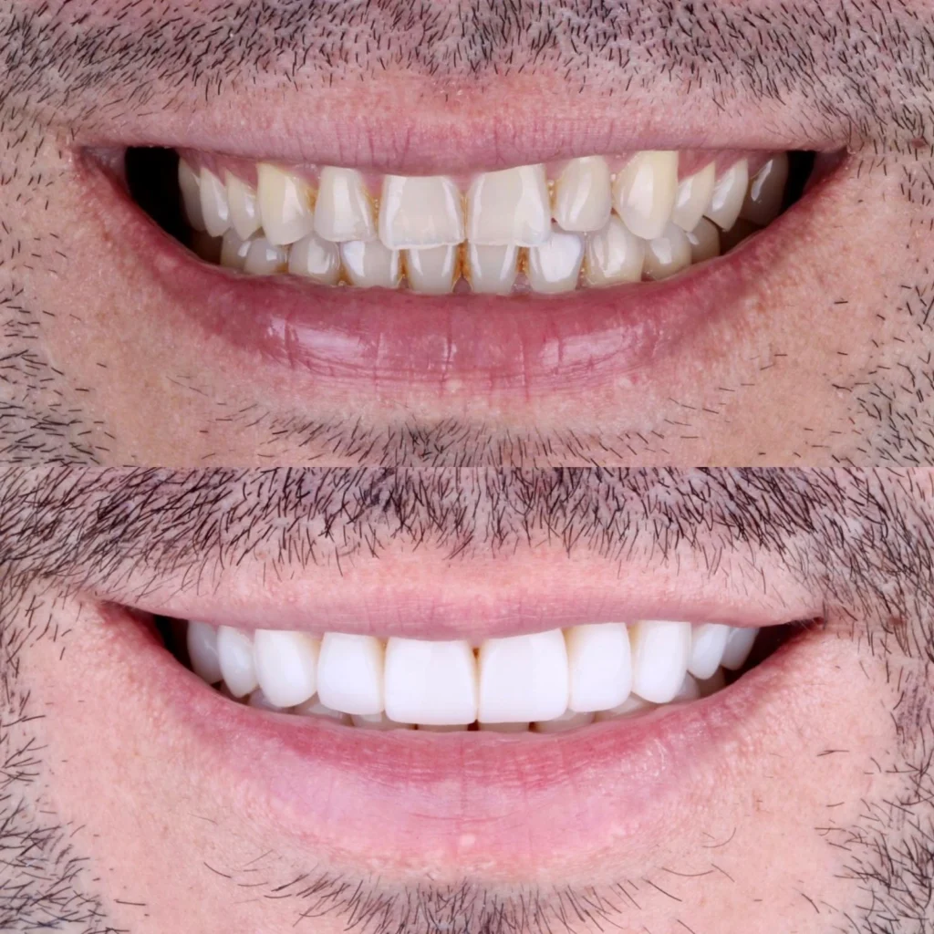 Dentadura perfecta AM Dental studio GDL