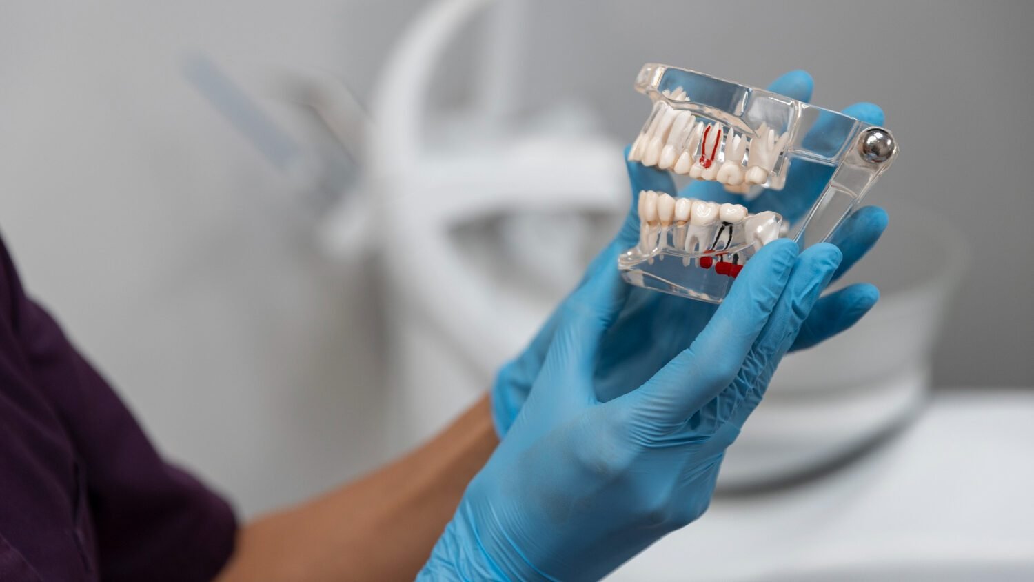 Implantes dentales AM Dental Studio.