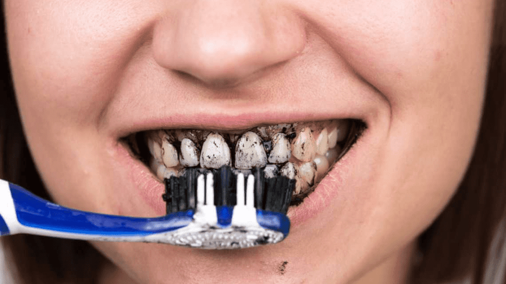blanqueamiento dental en casa con carbón.