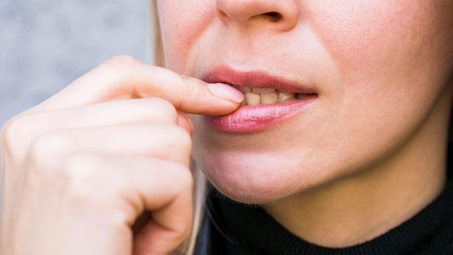 El bruxismo es un problema muy común am dental studio.