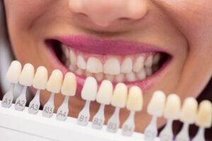 ¿Cómo recuperar ahora el esmalte dental?