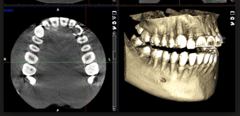 imagen 3D (CBCT)