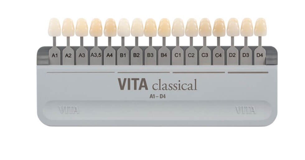 Comparativa de tonos dentales con guía VITA: a la izquierda un tono natural A2 y a la derecha un tono ultra-blanco artificial tipo 0M1 para carillas.